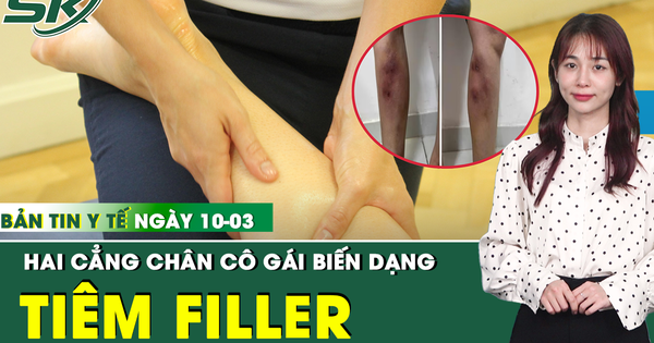 Bản Tin Y Tế 10/3: Tiêm filler để làm thẳng chân, cô gái 29 tuổi biến dạng cẳng chân