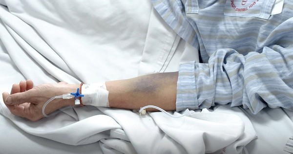 Hiểm họa sốt xuất huyết Dengue: Khi gánh nặng vượt qua những con số