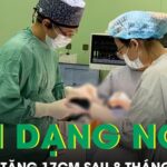 Khối u vú tăng 17cm sau 8 tháng khiến nữ du học sinh biến dạng ngực