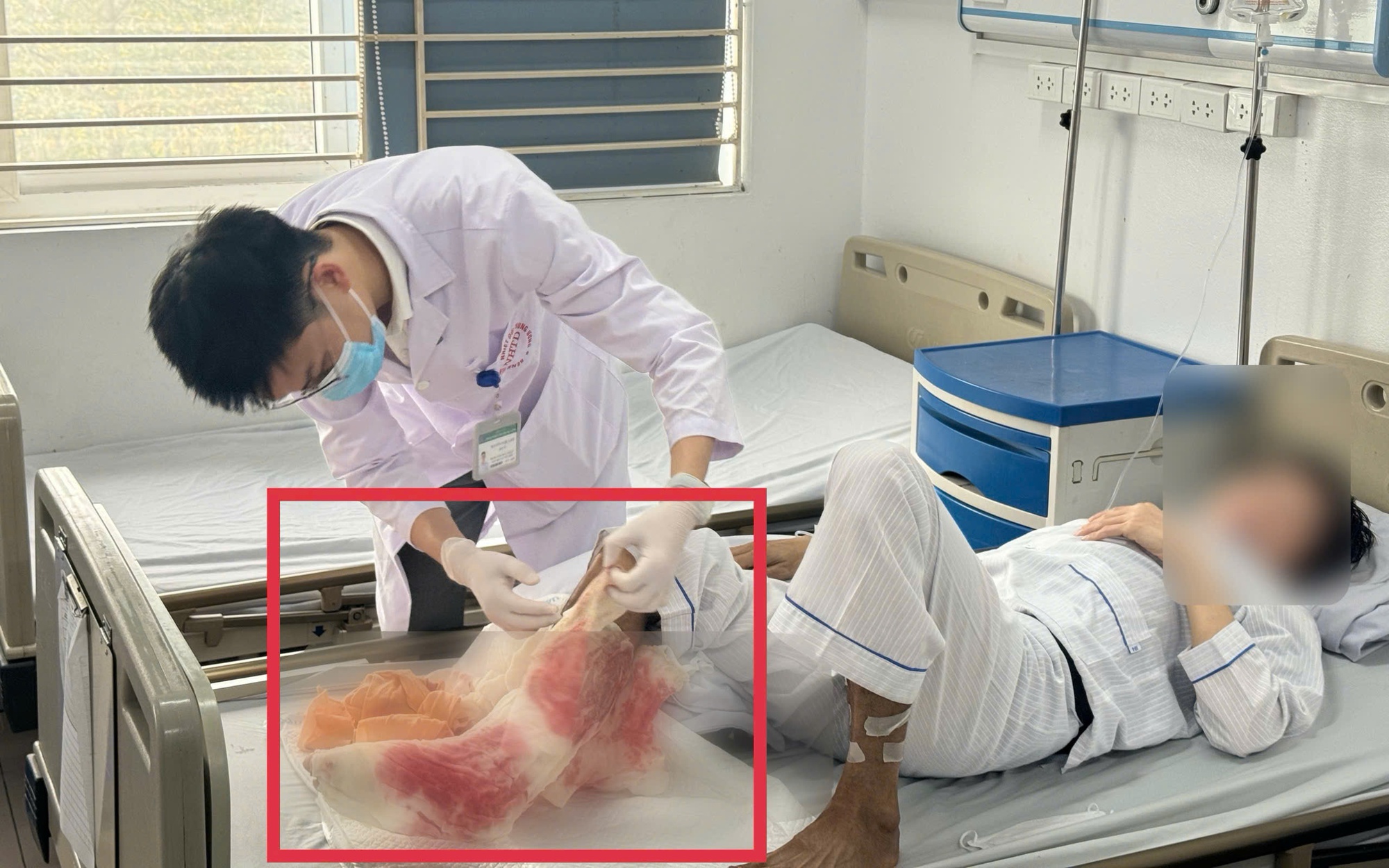 Vùng kín lở loét vì đắp thuốc lá dân gian chữa ngứa- Ảnh 1.