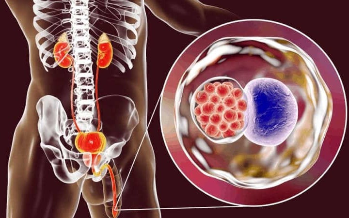 Sàng lọc các bệnh lây truyền qua đường tình dục - Ảnh 2.