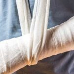 5 dấu hiệu nhận biết gãy xương, những cảnh báo sớm