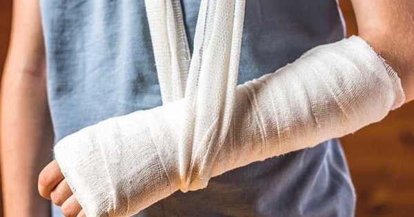 5 dấu hiệu nhận biết gãy xương, những cảnh báo sớm