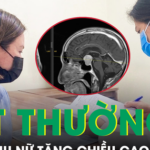 Người phụ nữ tăng chiều cao bất thường ở tuổi 40