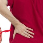 Sỏi thận có gây rối loạn cương dương?
