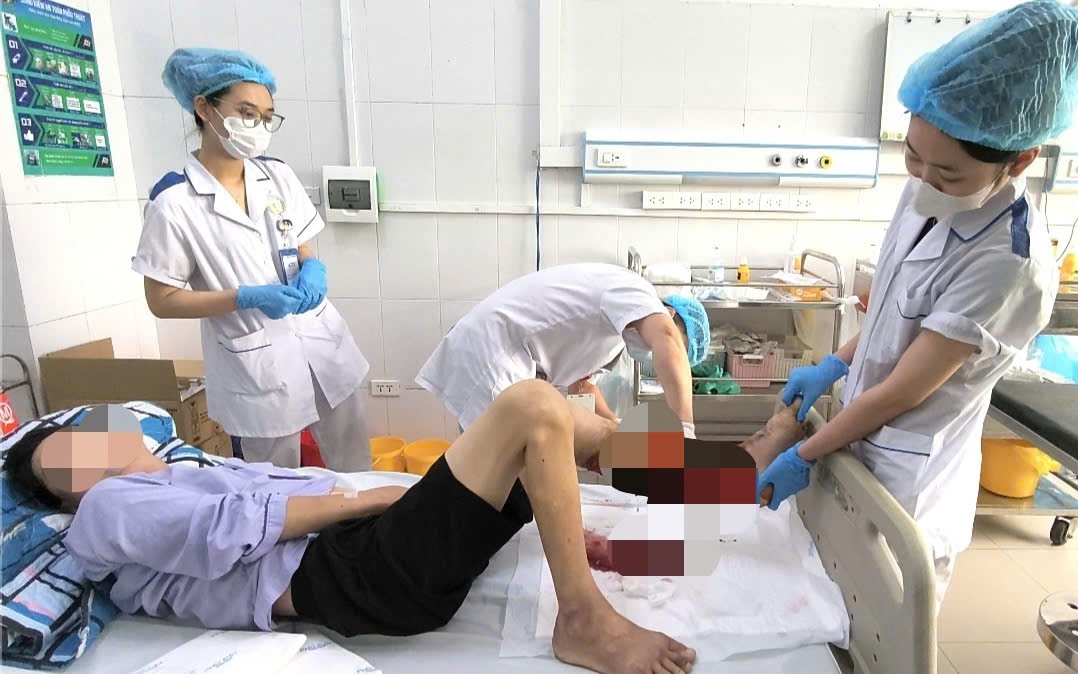 Cúm B không chỉ là cảm cúm thông thường, nhiều ca phải thở máy- Ảnh 1.