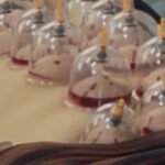 Chuyên gia lên tiếng về ‘giác hơi hút máu’ ở Hà Nội: Sai chuyên môn, đe dọa sức khoẻ, tính mạng