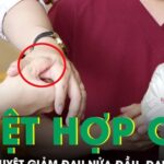 Cách bấm huyệt hợp cốc chữa đau nửa đầu, cổ vai gáy