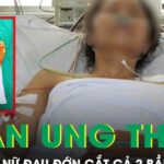 Người phụ nữ đau đớn cắt cả 2 bầu vú để chặn đứng ung thư