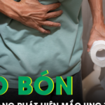 Người đàn ông bị táo bón lâu ngày bàng hoàng phát hiện ung thư dạ dày