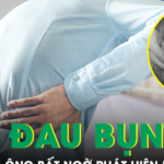 Thỉnh thoảng đau bụng, người đàn ông bất ngờ phát hiện khối u 3kg