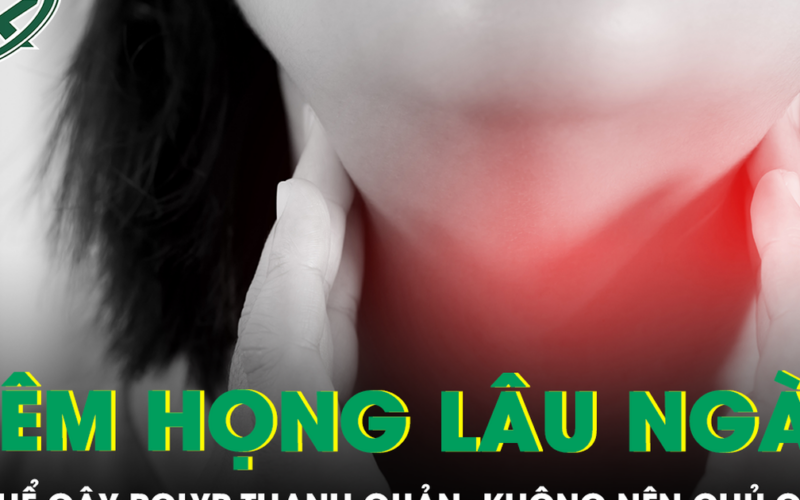 Đừng xem nhẹ bệnh viêm họng vì có thể gây polyp thanh quản