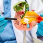 ‘Vũ khí bí mật’ giúp bệnh nhân chiến thắng ung thư tụy sau 6 năm