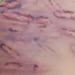 Sức khỏe của bé trai 2 tuổi bị mẹ ruột và cha dượng bạo hành giờ ra sao?