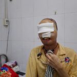Hành trình ‘làm lại gương mặt’ cho chàng thanh niên mang di chứng bỏng suốt 3 năm