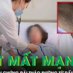 Tưởng da bẩn, cô gái 20 tuổi suýt mất mạng vì biến chứng đái tháo đường