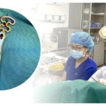 Bỏ quên vòng tránh thai suốt 30 năm, người phụ nữ 63 tuổi gặp biến chứng phụ khoa