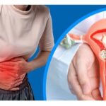 7 dấu hiệu thường gặp của lạc nội mạc tử cung chị em nên chú ý