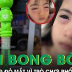Chơi bong bóng xà phòng, bé gái 5 tuổi sưng đỏ 2 mắt phải cấp cứu khẩn