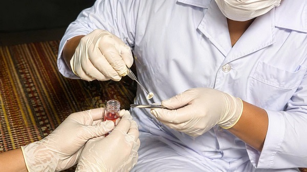 Ca hiến giác mạc đầu tiên tại Bệnh viện Đa khoa Bắc Ninh số 1- Ảnh 1. Ca hiến giác mạc đầu tiên tại Bệnh viện Đa khoa Bắc Ninh số 1- Ảnh 1.