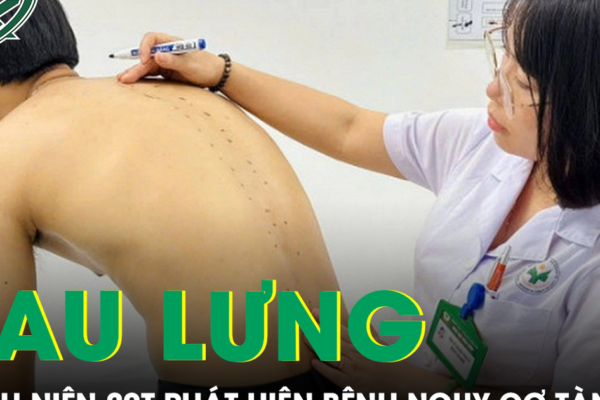 Tưởng đau lưng do tập gym, nam thanh niên 20 tuổi phát hiện mắc bệnh nguy cơ gây tàn phế