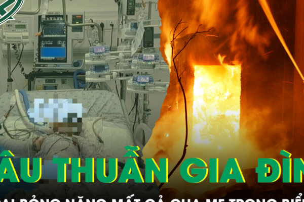 Căn nhà chìm trong biển lửa sau mâu thuẫn gia đình, bé 4 tuổi bỏng hơn 90% cơ thể