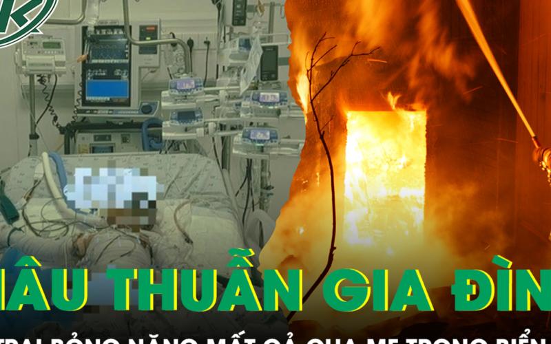 Căn nhà chìm trong biển lửa sau mâu thuẫn gia đình, bé 4 tuổi bỏng hơn 90% cơ thể
