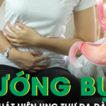 Chướng bụng kéo dài, người phụ nữ 48 tuổi bất ngờ phát hiện ung thư dạ dày di căn