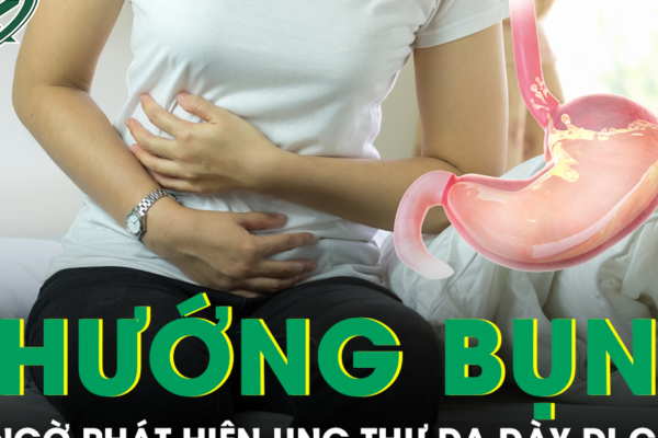 Chướng bụng kéo dài, người phụ nữ 48 tuổi bất ngờ phát hiện ung thư dạ dày di căn