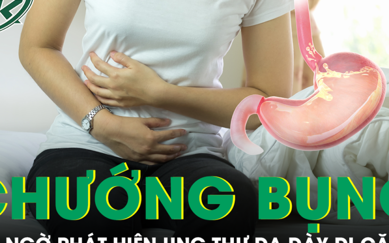 Chướng bụng kéo dài, người phụ nữ 48 tuổi bất ngờ phát hiện ung thư dạ dày di căn