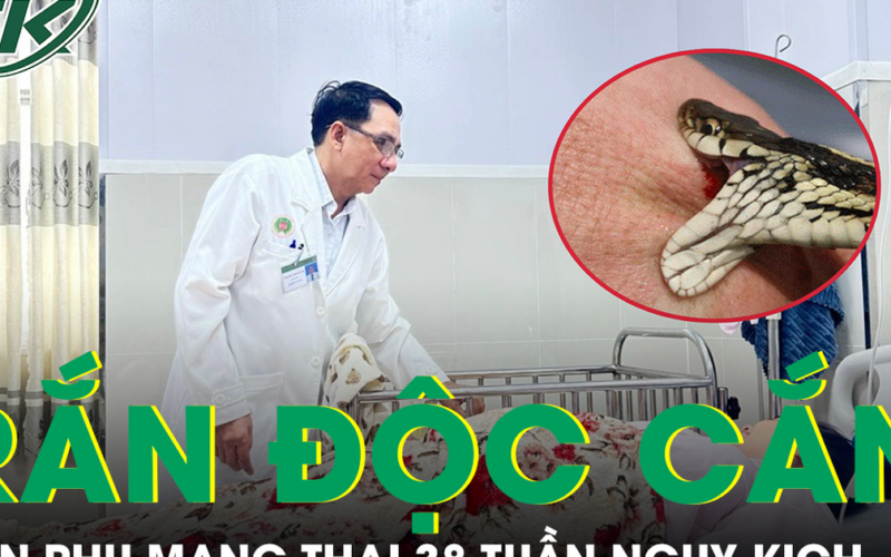 Bị rắn hổ mang cắn, sản phụ mang thai 38 tuần nguy kịch nhập viện khẩn