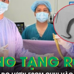 Người đàn ông thủng tạng rỗng do con lươn dài 50cm chui vào ổ bụng