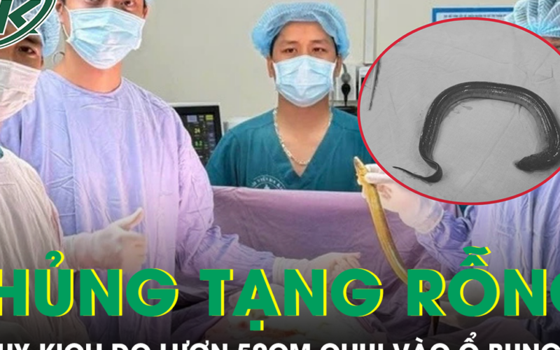 Người đàn ông thủng tạng rỗng do con lươn dài 50cm chui vào ổ bụng