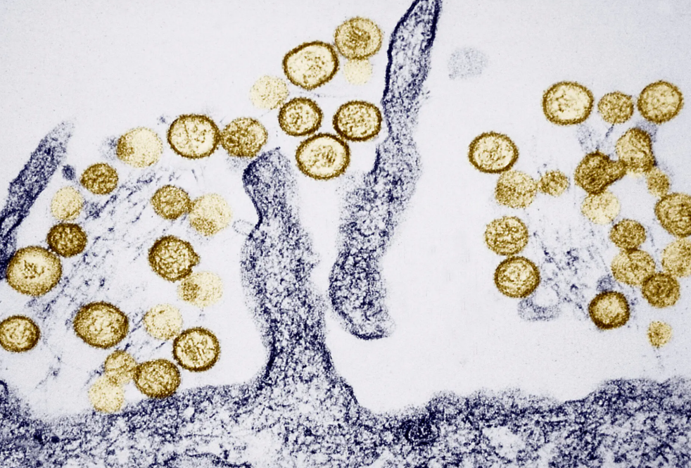 WHO đánh giá nguy cơ lây lan virus Hanta trong cộng đồng ở ‘mức thấp’