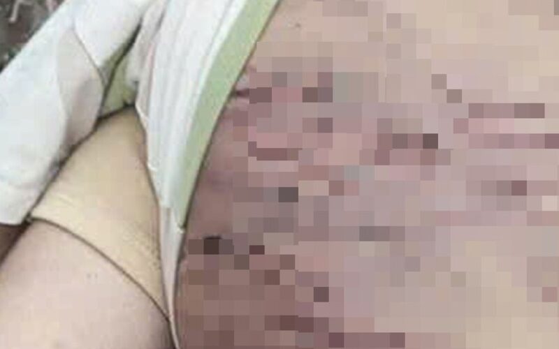 Bộ Y tế vào cuộc vụ bé trai 2 tuổi bị bạo hành dã man ở TP Hồ Chí Minh