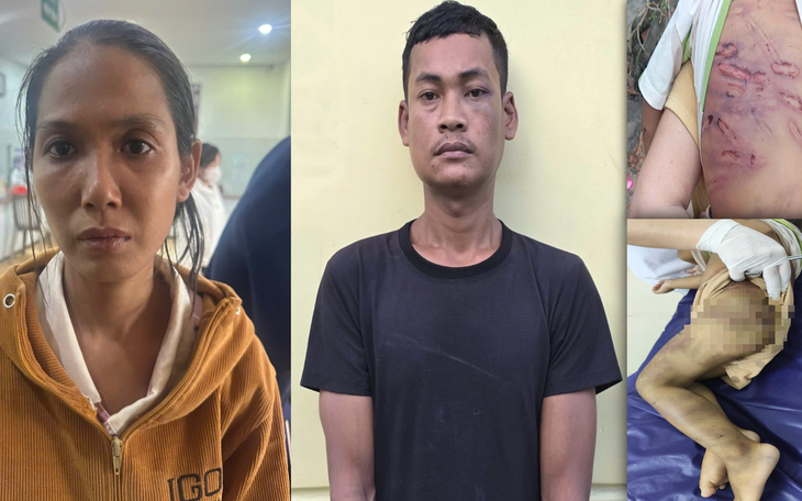 Bắt khẩn cấp mẹ ruột và "cha dượng" bạo hành bé trai 2 tuổi tại TPHCM