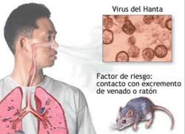 edit-vrhanta-17779509409071394380218 Bộ Y tế lên tiếng về virus Hanta sau chùm ca tử vong trên tàu du lịch nước ngoài- Ảnh 1.