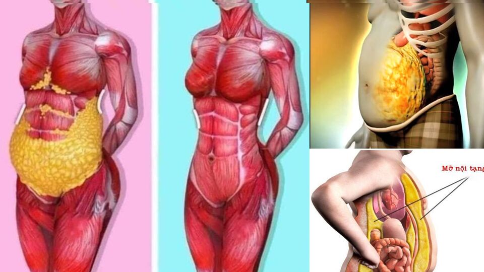 mo-noi-tang-17802222144221470245072 Mỡ nội tạng là một trong những yếu tố nguy hiểm đối với sức khỏe nhưng thường bị nhiều người bỏ qua.