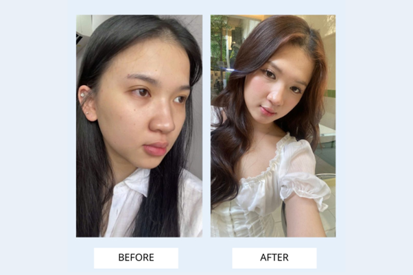 picture3-1780308637368165222927 Thương hiệu skincare Hàn Quốc tập trung nghiên cứu cơ chế lỗ chân lông được nhiều tín đồ làm đẹp quan tâm- Ảnh 3.