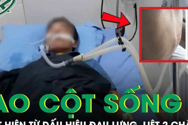Đau lưng kéo dài nhưng chủ quan, người đàn ông bất ngờ liệt hai chân vì lao cột sống