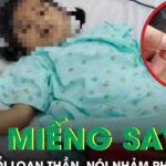 Bé gái 7 tuổi loạn thần, nói nhảm sau khi dán miếng chống say xe