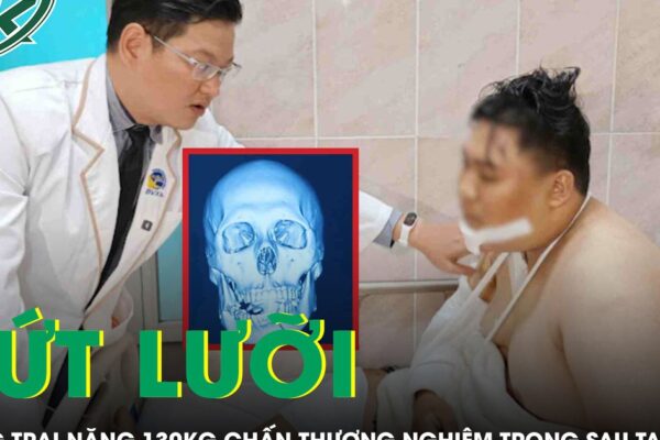 Cứu chàng trai nặng 130 kg đứt lưỡi sau tai nạn giao thông