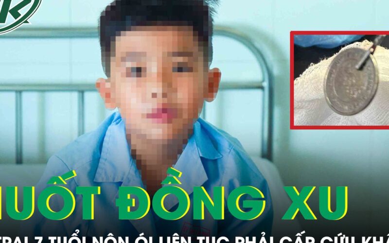 Nuốt đồng xu, bé trai 7 tuổi nôn ói liên tục phải cấp cứu khẩn