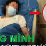 Rùng mình cảnh bác sĩ lấy ra 6 mảnh dao lam sắc nhọn từ cơ thể nữ bệnh nhân