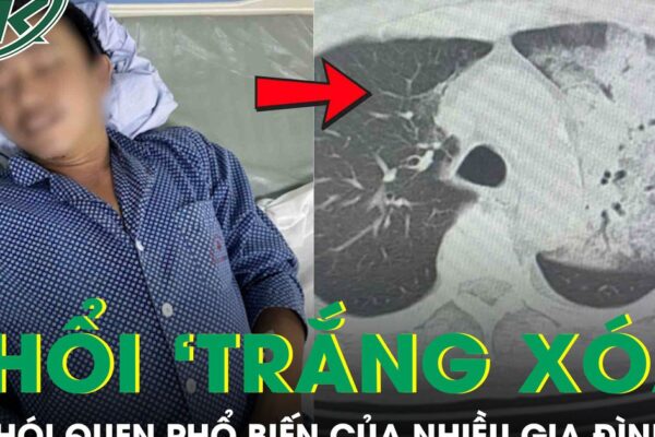 Tưởng cảm cúm, người đàn ông bất ngờ suy đa tạng, phổi ‘trắng xoá’ vì thói quen nhiều người mắc