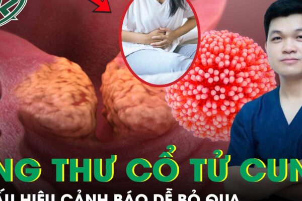 5 dấu hiệu âm thầm cảnh báo ung thư cổ tử cung nhiều người bỏ qua