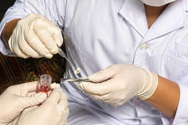 Ca hiến giác mạc đầu tiên tại Bệnh viện Đa khoa Bắc Ninh số 1