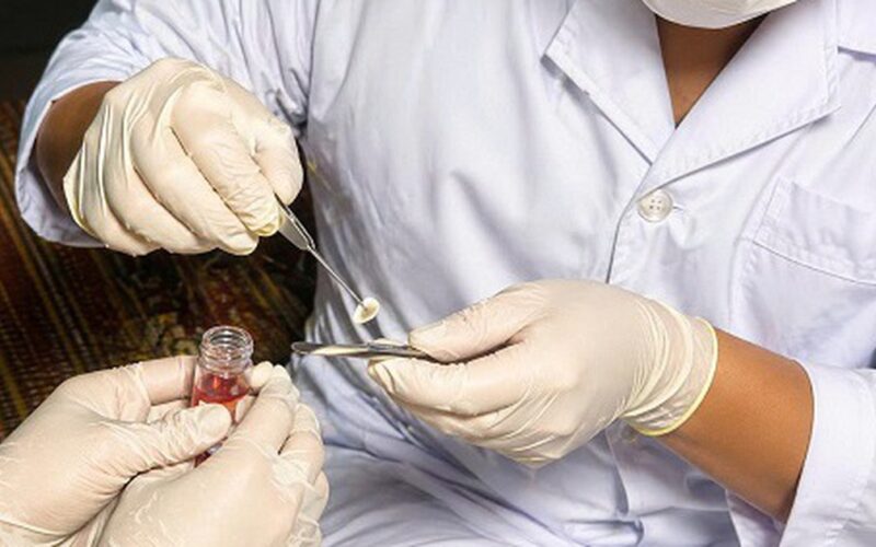 Ca hiến giác mạc đầu tiên tại Bệnh viện Đa khoa Bắc Ninh số 1