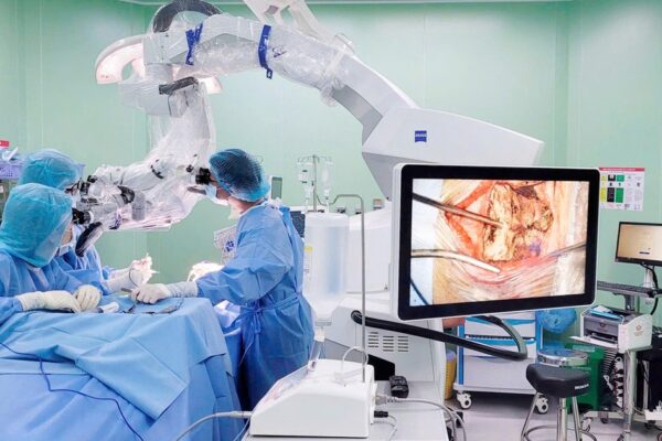 Cứu sống cụ bà 86 tuổi bị túi phình động mạch não nhờ phẫu thuật lỗ khóa