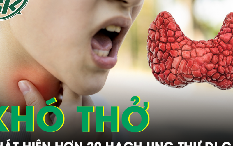 Khó thở mất tiếng, người phụ nữ phát hiện hơn 20 hạch ung thư di căn